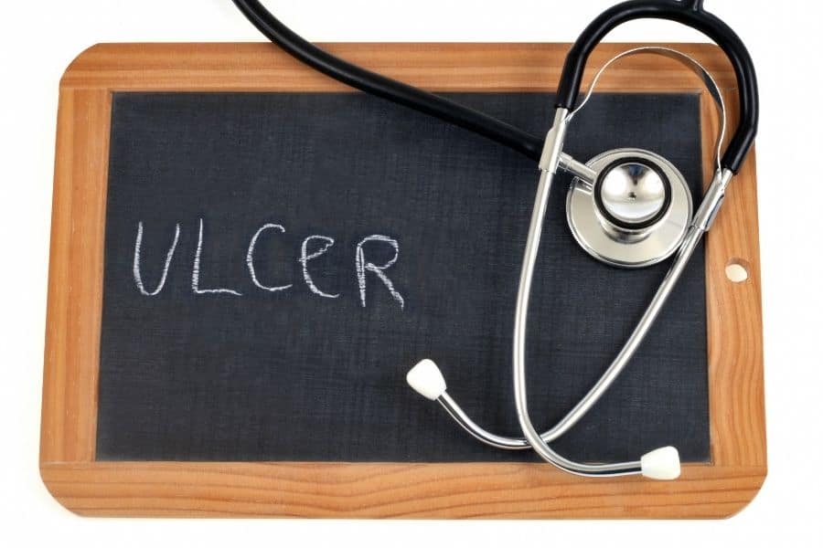 Combating Ulcers using kalanchoe